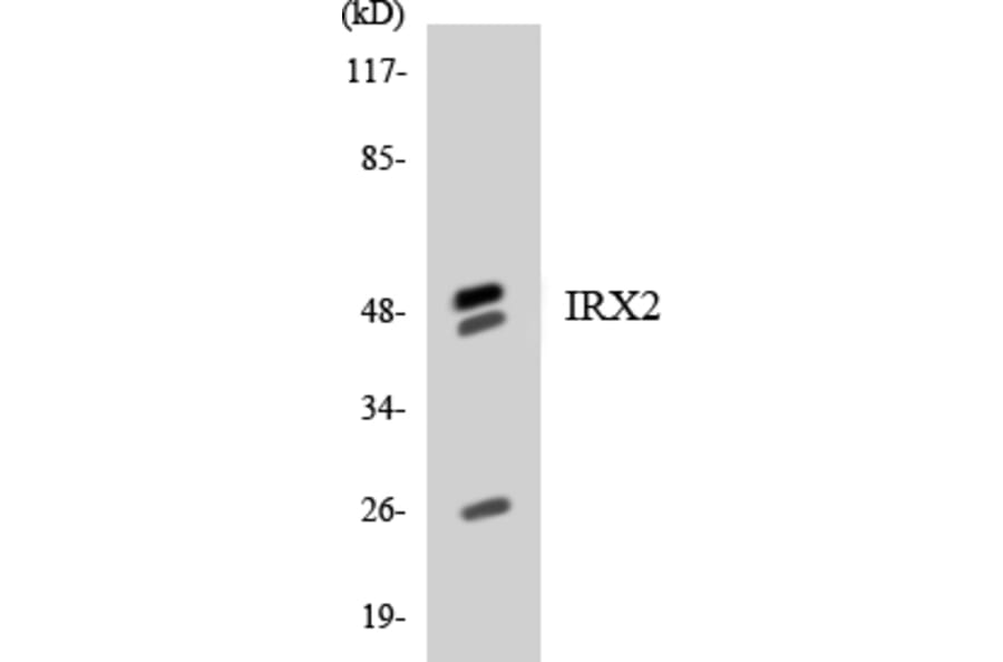 Western Blot - Anti-IRX2 Antibody (R12-2936) - Antibodies.com