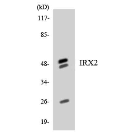 Western Blot - Anti-IRX2 Antibody (R12-2936) - Antibodies.com