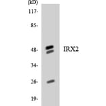 Western Blot - Anti-IRX2 Antibody (R12-2936) - Antibodies.com