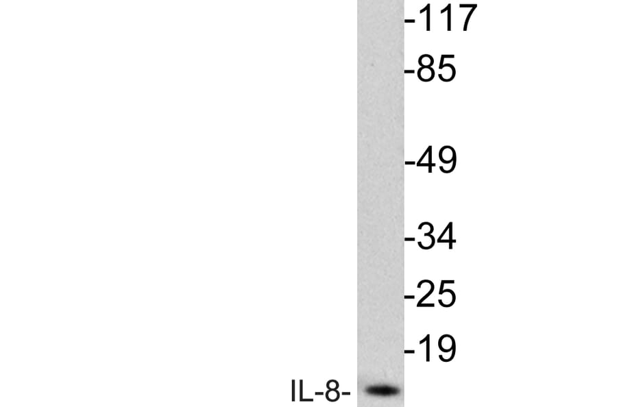 Western Blot - Anti-IL-8 Antibody (R12-2214) - Antibodies.com