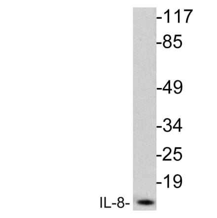 Western Blot - Anti-IL-8 Antibody (R12-2214) - Antibodies.com