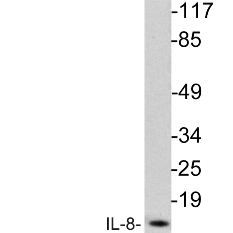 Western Blot - Anti-IL-8 Antibody (R12-2214) - Antibodies.com