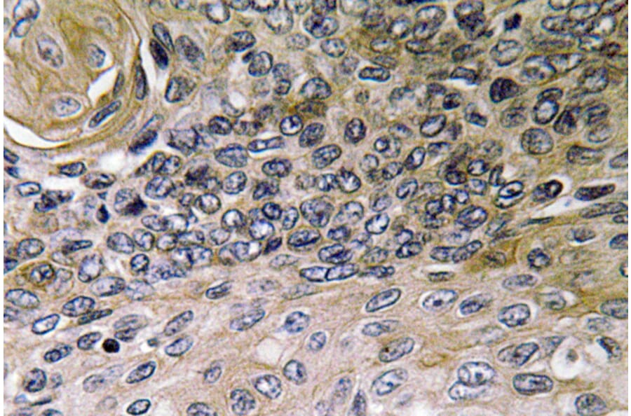 Immunohistochemistry - Anti-IL-8 Antibody (R12-2214) - Antibodies.com