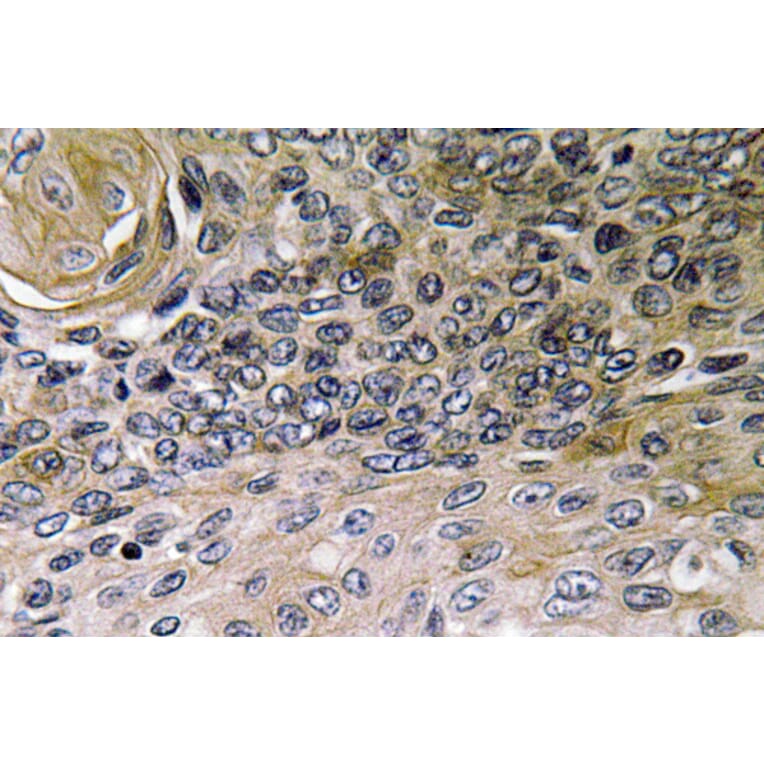 Immunohistochemistry - Anti-IL-8 Antibody (R12-2214) - Antibodies.com