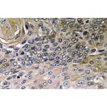 Immunohistochemistry - Anti-IL-8 Antibody (R12-2214) - Antibodies.com