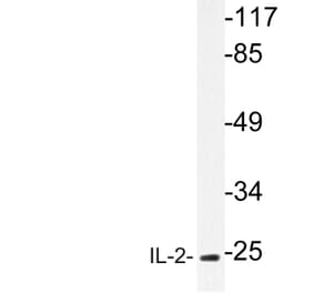 Western Blot - Anti-IL-2 Antibody (R12-2205) - Antibodies.com