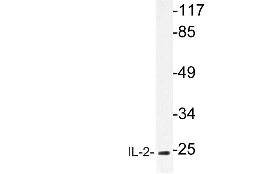 Western Blot - Anti-IL-2 Antibody (R12-2205) - Antibodies.com