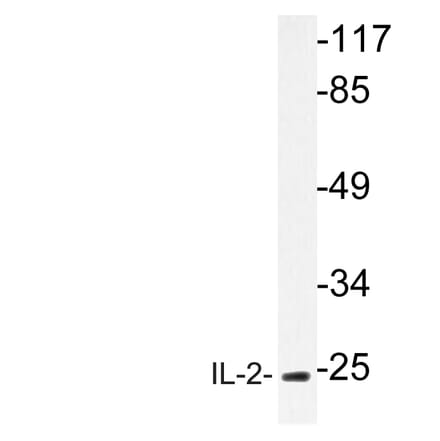 Western Blot - Anti-IL-2 Antibody (R12-2205) - Antibodies.com