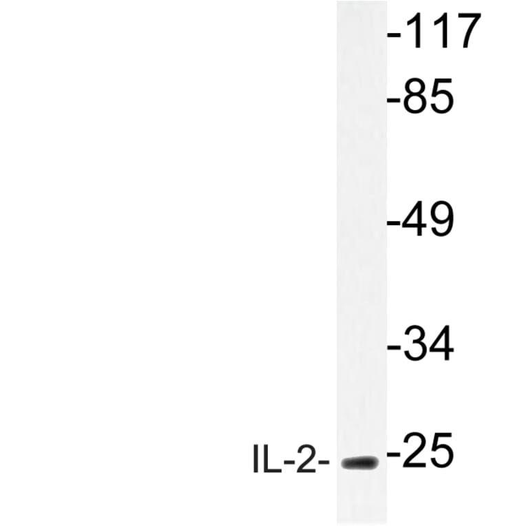Western Blot - Anti-IL-2 Antibody (R12-2205) - Antibodies.com