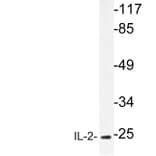 Western Blot - Anti-IL-2 Antibody (R12-2205) - Antibodies.com
