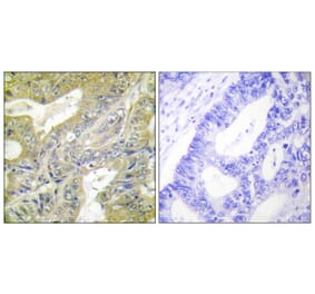 Immunohistochemistry - Anti-HEXB Antibody (C10295) - Antibodies.com