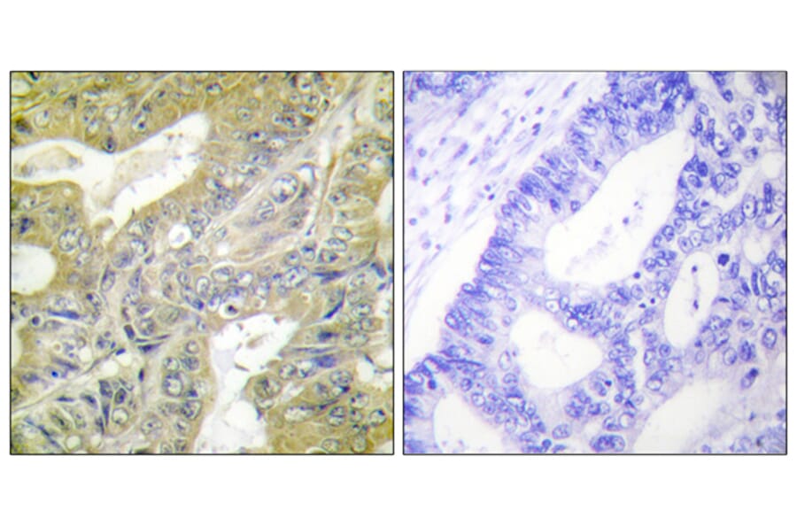 Immunohistochemistry - Anti-HEXB Antibody (C10295) - Antibodies.com