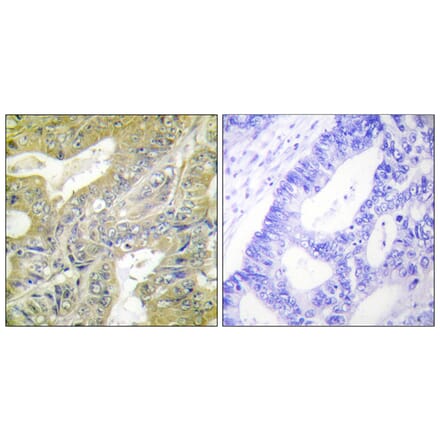Immunohistochemistry - Anti-HEXB Antibody (C10295) - Antibodies.com