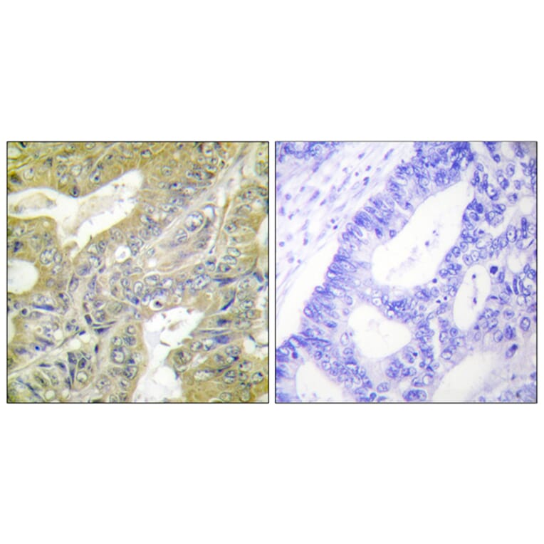 Immunohistochemistry - Anti-HEXB Antibody (C10295) - Antibodies.com