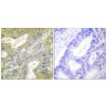 Immunohistochemistry - Anti-HEXB Antibody (C10295) - Antibodies.com