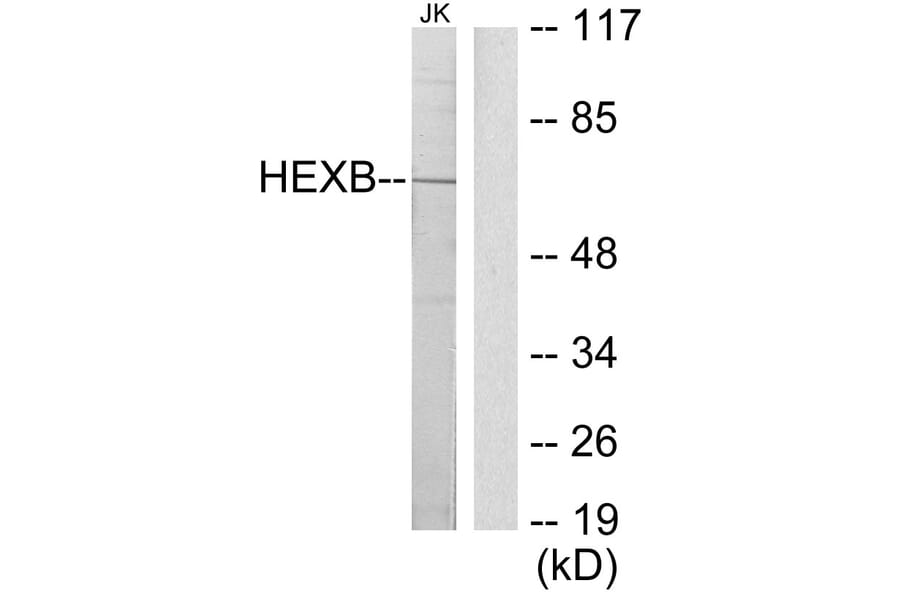 Western Blot - Anti-HEXB Antibody (C10295) - Antibodies.com