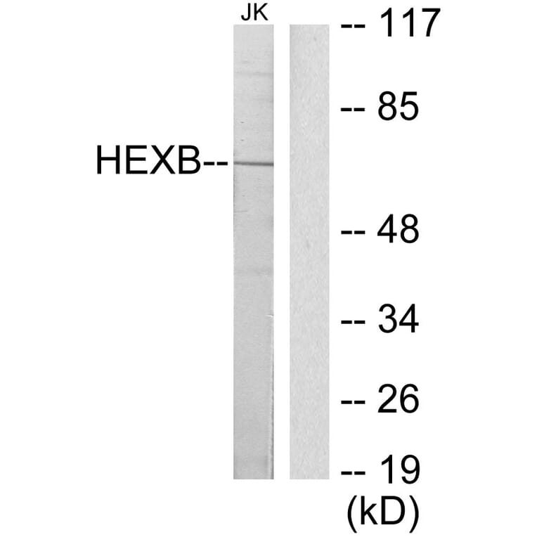 Western Blot - Anti-HEXB Antibody (C10295) - Antibodies.com
