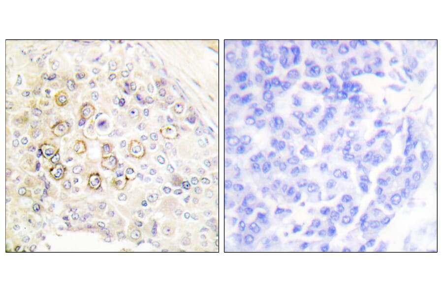 Immunohistochemistry - Anti-HER3 Antibody (C0150) - Antibodies.com