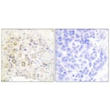 Immunohistochemistry - Anti-HER3 Antibody (C0150) - Antibodies.com