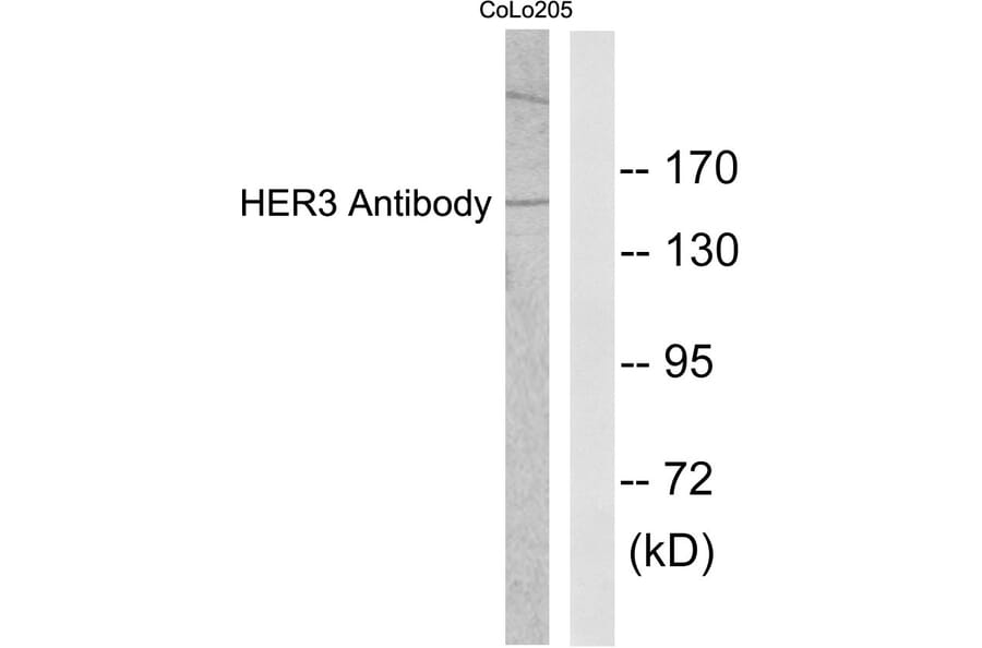 Western Blot - Anti-HER3 Antibody (C0150) - Antibodies.com