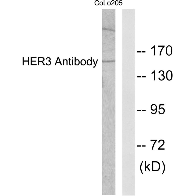 Western Blot - Anti-HER3 Antibody (C0150) - Antibodies.com