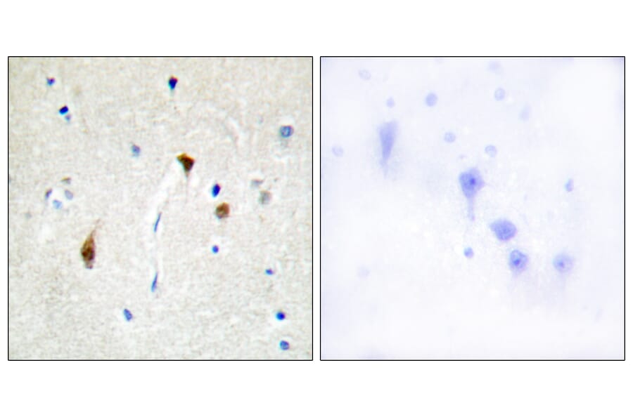 Immunohistochemistry - Anti-HAIR Antibody (C10111) - Antibodies.com