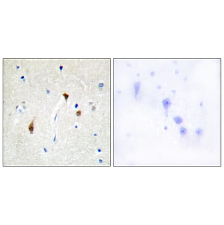 Immunohistochemistry - Anti-HAIR Antibody (C10111) - Antibodies.com