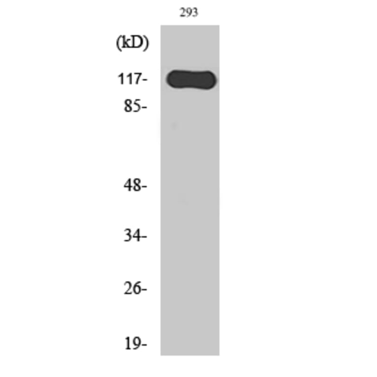 Western Blot - Anti-HAIR Antibody (C10111) - Antibodies.com