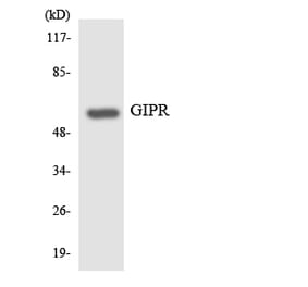 Western Blot - Anti-GIPR Antibody (R12-2809) - Antibodies.com