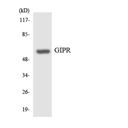 Western Blot - Anti-GIPR Antibody (R12-2809) - Antibodies.com