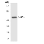 Western Blot - Anti-GIPR Antibody (R12-2809) - Antibodies.com