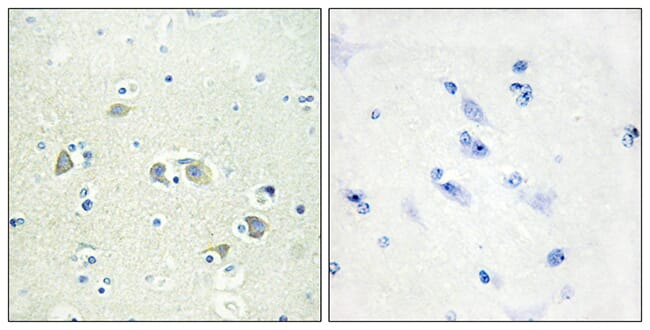 ATF-6α (F-7) FITC Antibody sc-166659 FITC from Santa Cruz