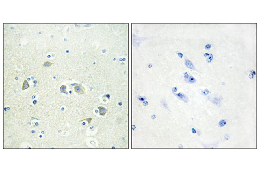 Immunohistochemistry - Anti-GAS6 Antibody (C11029) - Antibodies.com