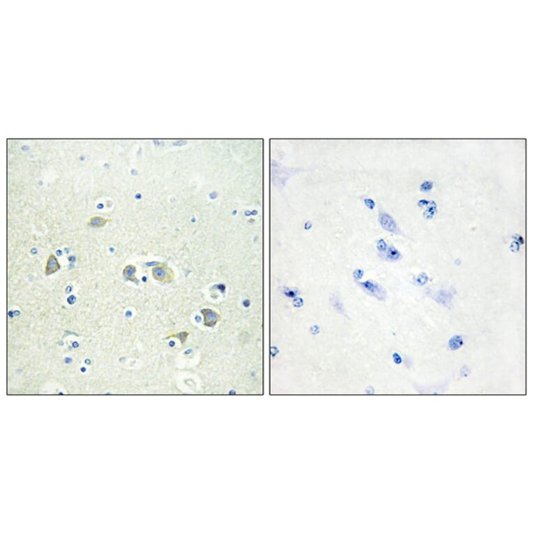 Immunohistochemistry - Anti-GAS6 Antibody (C11029) - Antibodies.com