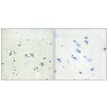 Immunohistochemistry - Anti-GAS6 Antibody (C11029) - Antibodies.com