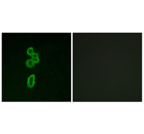 Immunofluorescence - Anti-FZD6 Antibody (G260) - Antibodies.com