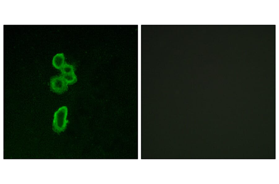 Immunofluorescence - Anti-FZD6 Antibody (G260) - Antibodies.com