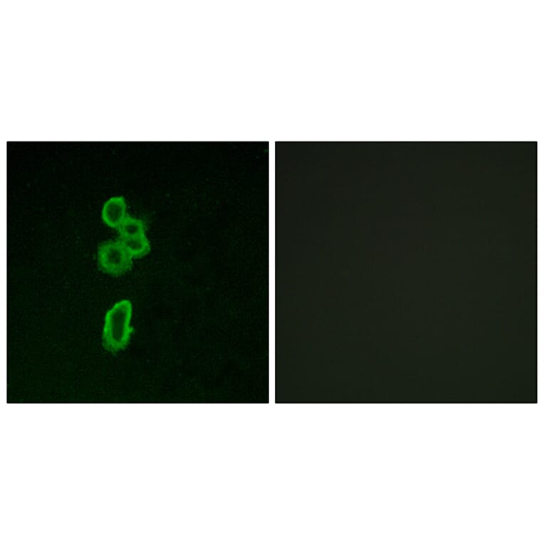 Immunofluorescence - Anti-FZD6 Antibody (G260) - Antibodies.com