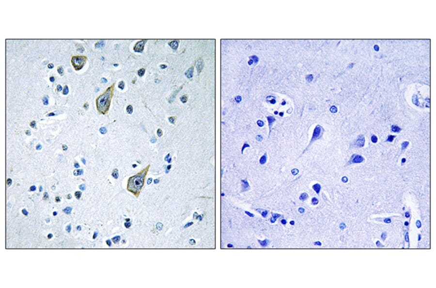 Immunohistochemistry - Anti-FZD6 Antibody (G260) - Antibodies.com