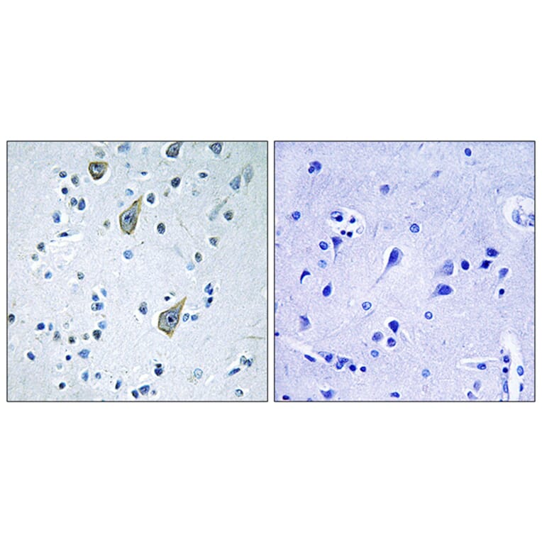Immunohistochemistry - Anti-FZD6 Antibody (G260) - Antibodies.com