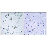 Immunohistochemistry - Anti-FZD6 Antibody (G260) - Antibodies.com