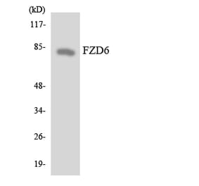 Western Blot - Anti-FZD6 Antibody (R12-2785) - Antibodies.com