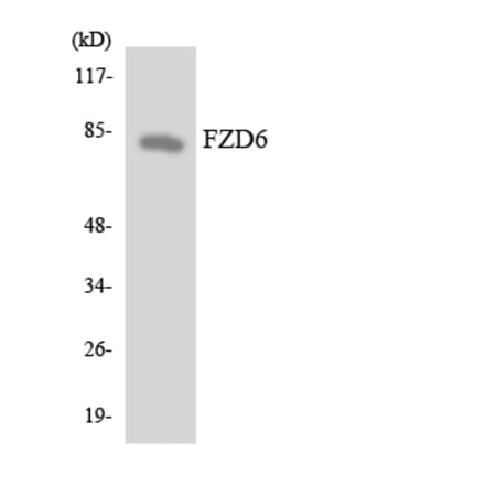 Western Blot - Anti-FZD6 Antibody (R12-2785) - Antibodies.com