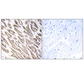 Immunohistochemistry - Anti-F13B Antibody (C15182) - Antibodies.com