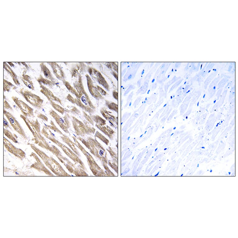 Immunohistochemistry - Anti-F13B Antibody (C15182) - Antibodies.com