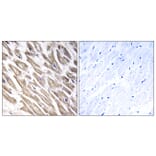 Immunohistochemistry - Anti-F13B Antibody (C15182) - Antibodies.com