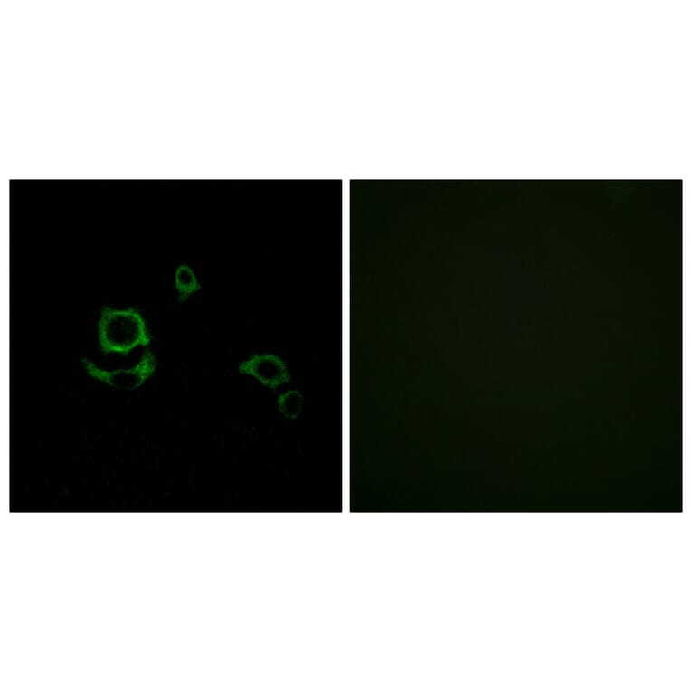 Immunofluorescence - Anti-F13B Antibody (C15182) - Antibodies.com