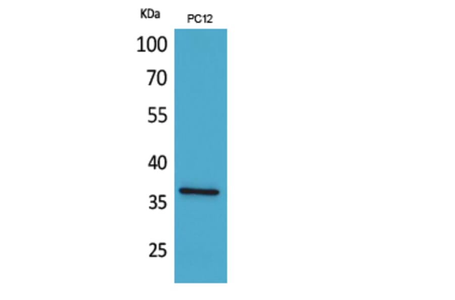 Western Blot - Anti-F11R Antibody (C30522) - Antibodies.com