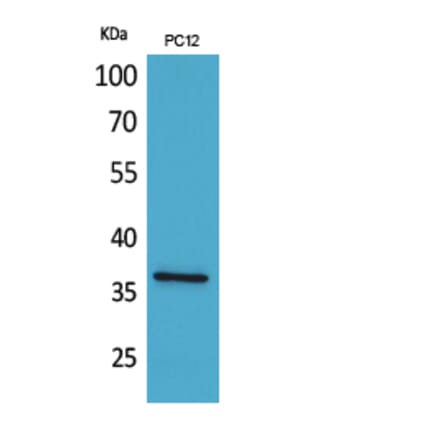 Western Blot - Anti-F11R Antibody (C30522) - Antibodies.com