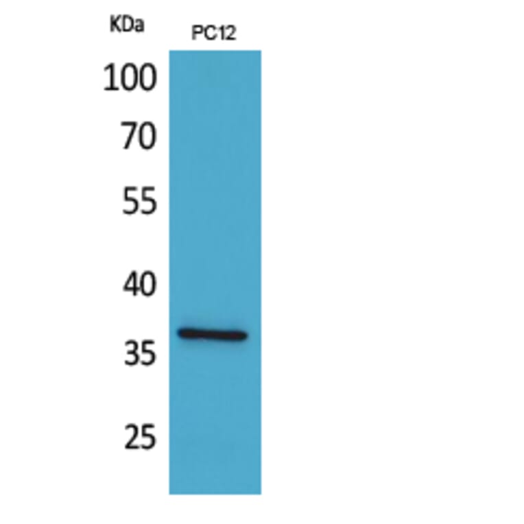 Western Blot - Anti-F11R Antibody (C30522) - Antibodies.com